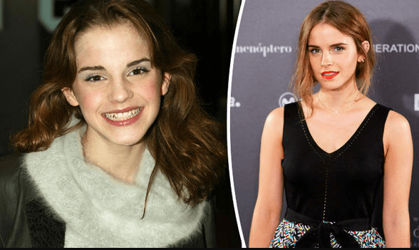 EMMA CHARLOTTE DUERRE WATSON – HERMONİE GRANGER EMMA CHARLOTTE DUERRE WATSON – HERMONİE GRANGER